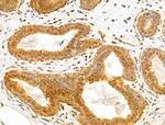 TAF12 Antibody in Immunohistochemistry (Paraffin) (IHC (P))