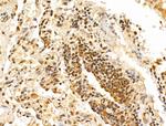 TAF12 Antibody in Immunohistochemistry (Paraffin) (IHC (P))