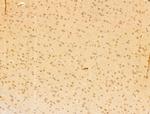 TAF12 Antibody in Immunohistochemistry (Paraffin) (IHC (P))