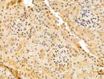 TAF12 Antibody in Immunohistochemistry (Paraffin) (IHC (P))