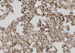 TIA-1 Antibody in Immunohistochemistry (Paraffin) (IHC (P))