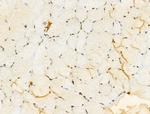 TIA-1 Antibody in Immunohistochemistry (Paraffin) (IHC (P))