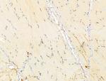 TIA-1 Antibody in Immunohistochemistry (Paraffin) (IHC (P))