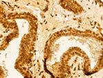 TIA-1 Antibody in Immunohistochemistry (Paraffin) (IHC (P))