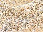 TIA-1 Antibody in Immunohistochemistry (Paraffin) (IHC (P))