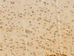 EXOC1 Antibody in Immunohistochemistry (Paraffin) (IHC (P))