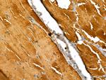 EXOC1 Antibody in Immunohistochemistry (Paraffin) (IHC (P))