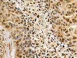 LARP7 Antibody in Immunohistochemistry (Paraffin) (IHC (P))