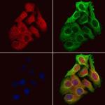 OTUD7B Antibody in Immunocytochemistry (ICC/IF)