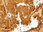 P4HA1 Antibody in Immunohistochemistry (Paraffin) (IHC (P))