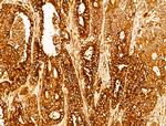 P4HA1 Antibody in Immunohistochemistry (Paraffin) (IHC (P))