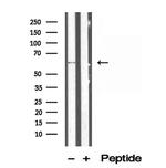 P4HA1 Antibody in Western Blot (WB)