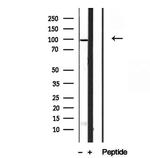 SBP2 Antibody in Western Blot (WB)