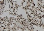 CEP164 Antibody in Immunohistochemistry (Paraffin) (IHC (P))