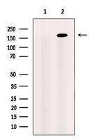 CEP164 Antibody in Western Blot (WB)