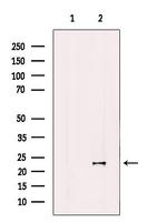 COQ7 Antibody in Western Blot (WB)