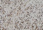 CPSF4 Antibody in Immunohistochemistry (Paraffin) (IHC (P))