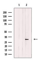 CPSF4 Antibody in Western Blot (WB)