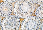 DYX1C1 Antibody in Immunohistochemistry (Paraffin) (IHC (P))