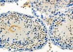 DYX1C1 Antibody in Immunohistochemistry (Paraffin) (IHC (P))