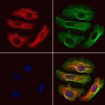 HBE1 Antibody in Immunocytochemistry (ICC/IF)