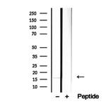 HBE1 Antibody in Western Blot (WB)