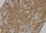 KIF18A Antibody in Immunohistochemistry (Paraffin) (IHC (P))