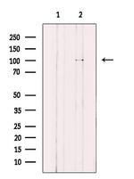 KIF18A Antibody in Western Blot (WB)