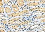 MAD2L2 Antibody in Immunohistochemistry (Paraffin) (IHC (P))