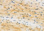 Mast Cell Chymase Antibody in Immunohistochemistry (Paraffin) (IHC (P))