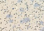 SSNA1 Antibody in Immunohistochemistry (Paraffin) (IHC (P))