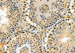 SSNA1 Antibody in Immunohistochemistry (Paraffin) (IHC (P))