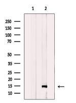 SSNA1 Antibody in Western Blot (WB)