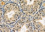 NUFIP1 Antibody in Immunohistochemistry (Paraffin) (IHC (P))