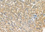 STX16 Antibody in Immunohistochemistry (Paraffin) (IHC (P))