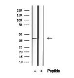 STX16 Antibody in Western Blot (WB)