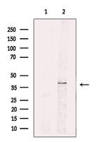 STX16 Antibody in Western Blot (WB)