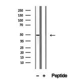 UQCRC2 Antibody in Western Blot (WB)