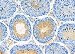 WBP2NL Antibody in Immunohistochemistry (Paraffin) (IHC (P))