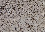 ZC3HAV1 Antibody in Immunohistochemistry (Paraffin) (IHC (P))