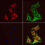 ALP Antibody in Immunocytochemistry (ICC/IF)