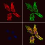 RTRAF Antibody in Immunocytochemistry (ICC/IF)