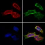 CPS1 Antibody in Immunocytochemistry (ICC/IF)