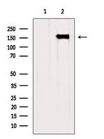 CPS1 Antibody in Western Blot (WB)