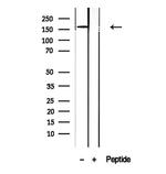 CPS1 Antibody in Western Blot (WB)