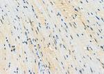 E2F3 Antibody in Immunohistochemistry (Paraffin) (IHC (P))