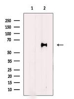 HPSE Antibody in Western Blot (WB)