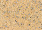 LGP2 Antibody in Immunohistochemistry (Paraffin) (IHC (P))