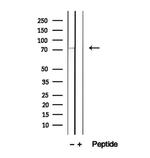 LGP2 Antibody in Western Blot (WB)