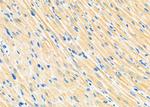 PIP5K1A Antibody in Immunohistochemistry (Paraffin) (IHC (P))